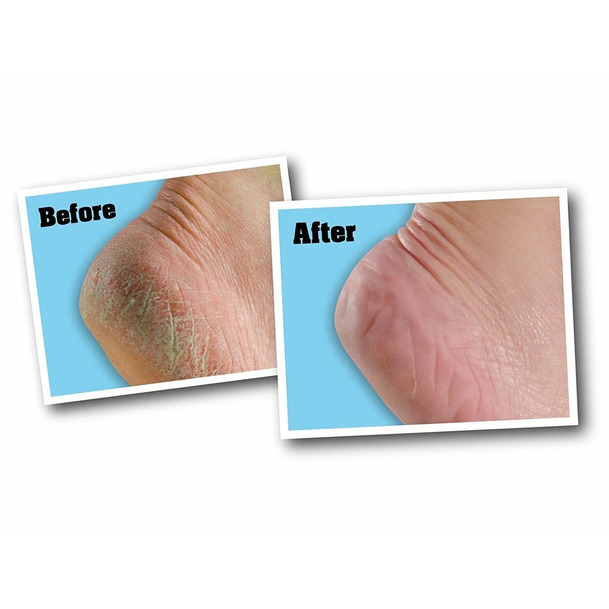 هلثي فيية - كريم للقدمين