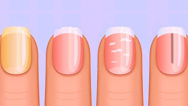 What Your Nails Say About Your Health